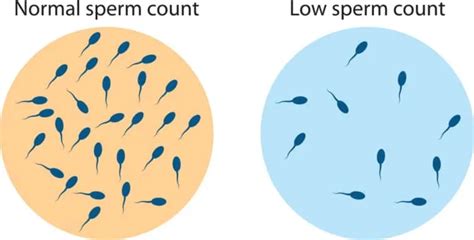 精液の色でわかる精子の数｜色が透明だと不妊症検査 